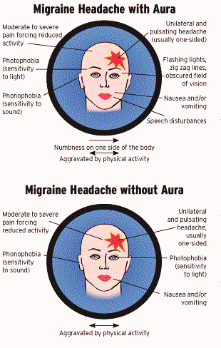 Migraine Homeopathic Cure, Treatment Using Homeopathy With Excellent ...